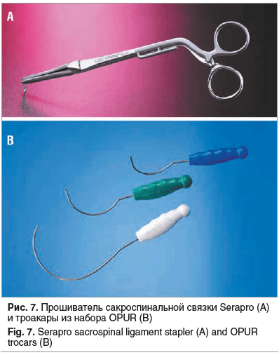 Рис. 7. Прошиватель сакроспинальной связки Serapro (A) и троакары из набора OPUR (В) Fig. 7. Serapro sacrospinal ligament stapler (A) and OPUR trocars (B)