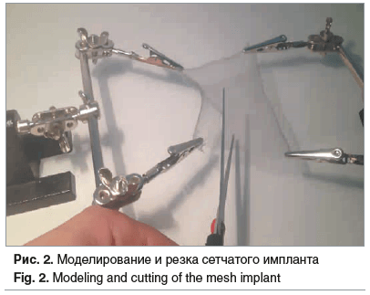 Рис. 2. Моделирование и резка сетчатого импланта Fig. 2. Modeling and cutting of the mesh implant