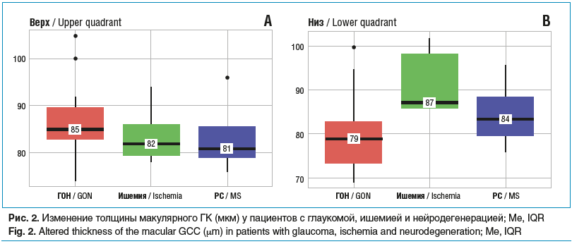 Рис. 2. Изменение толщины макулярного ГК (мкм) у пациентов с глаукомой, ишемией и нейродегенерацией; Me, IQR Fig. 2. Altered thickness of the macular GCC (μm) in patients with glaucoma, ischemia and neurodegeneration; Me, IQR