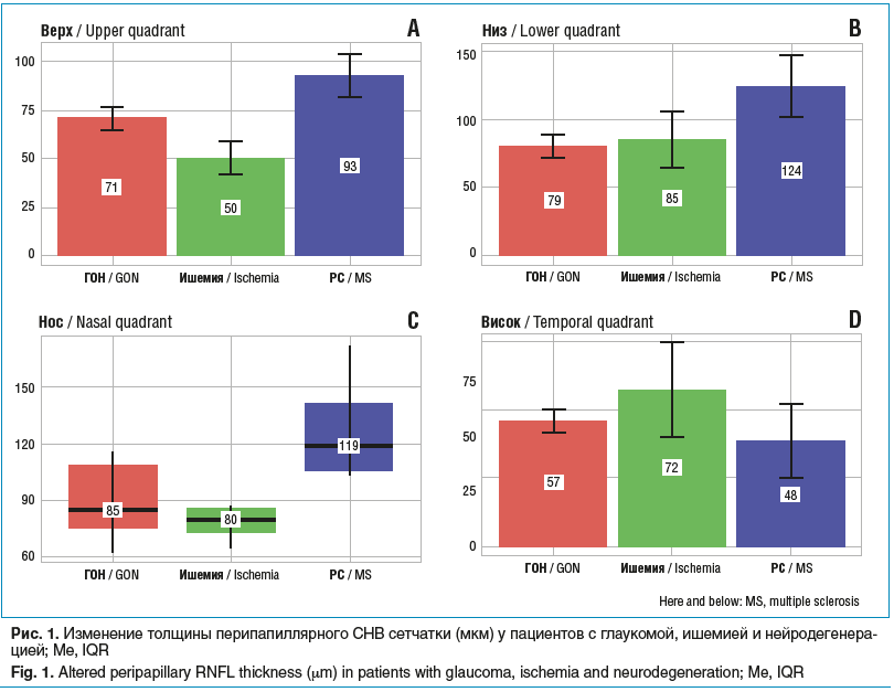 Рис. 1. Изменение толщины перипапиллярного СНВ сетчатки (мкм) у пациентов с глаукомой, ишемией и нейродегенера- цией; Me, IQR Fig. 1. Altered peripapillary RNFL thickness (μm) in patients with glaucoma, ischemia and neurodegeneration; Me, IQR