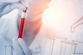 Диагностика сахарного диабета и вариантов кинетики глюкозы во внутривенном тесте