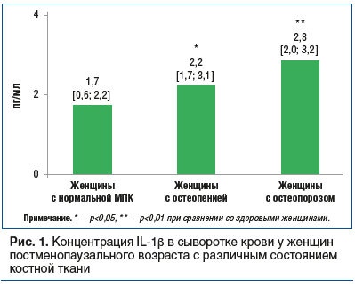 Рис. 1. Концентрация IL-1β в сыворотке крови у женщин постменопаузального возраста с различным состоянием костной ткани