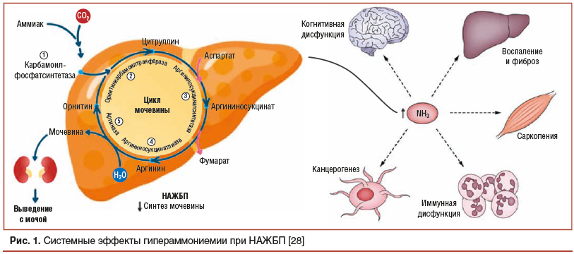 Рис. 1. Системные эффекты гипераммониемии при НАЖБП [28]