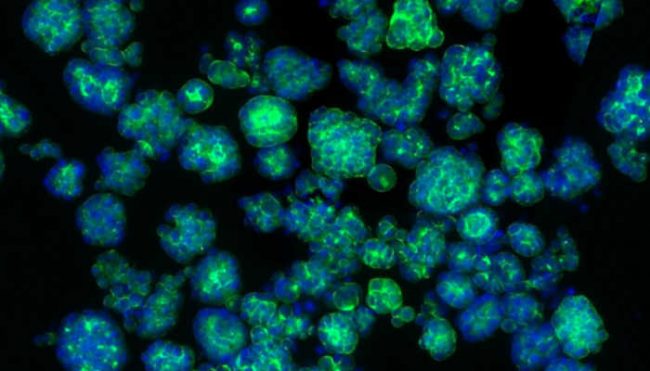 Рак перепрограммирует нервные клетки для стимулирования роста