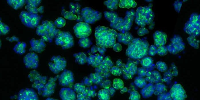 Рак перепрограммирует нервные клетки для стимулирования роста