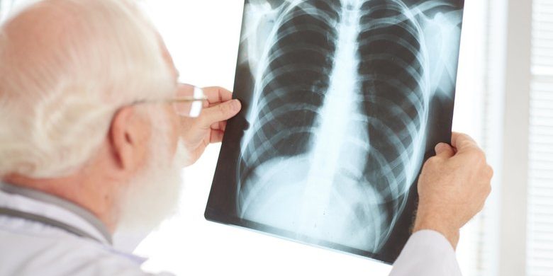 В России создали метод диагностики муковисцидоза по выдыхаемому воздуху