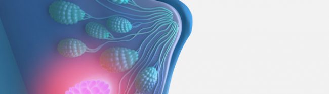 Камизестрант компании AstraZeneca увеличивает выживаемость при HR‑положительном раке молочной железы