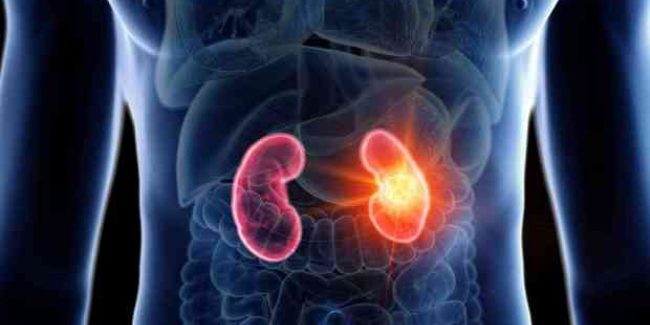 Hypertension: гипертония вызывает структурные повреждения почек