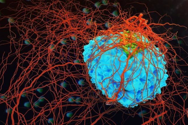 Cancer: стихийные бедствия приводят к поздней диагностике рака