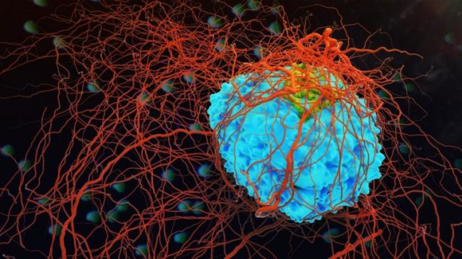 Cancer: стихийные бедствия приводят к поздней диагностике рака