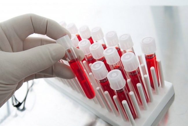 Blood Advances: статины могут значительно повысить выживаемость при раке крови