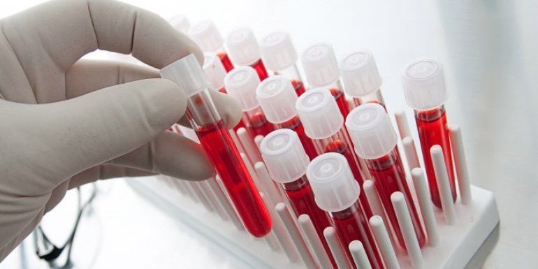 Blood Advances: статины могут значительно повысить выживаемость при раке крови