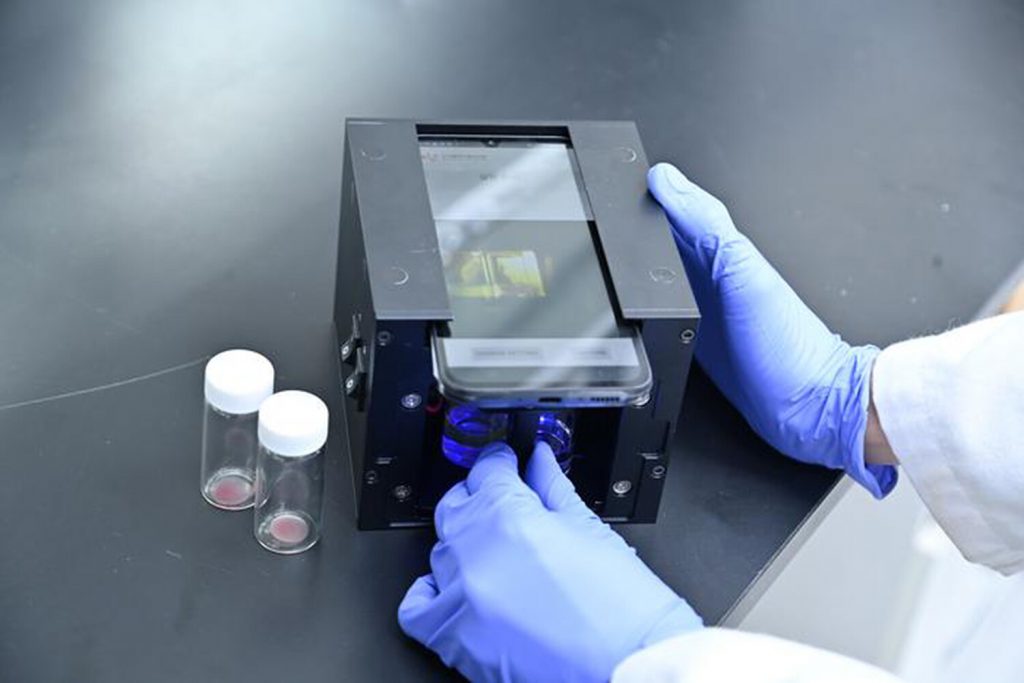 Cancer Research: разработан метод выявления рака простаты с помощью анализа