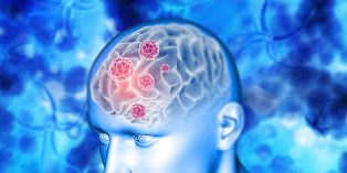 JAMA: нарушения сна и недосыпание не затрагивают одинаковые области мозга