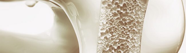 Ученые нашли способ удешевить производство материалов для костных имплантатов