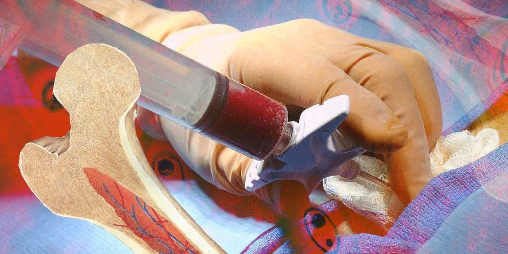 Естественное омоложение костного мозга — Медицина 2.0