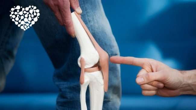 Здоровые привычки, которые помогут лечить остеоартрит