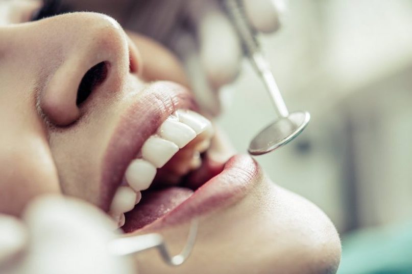 Врач Маруфиди: два фактора, влияющие на состояние зубов, передаются по