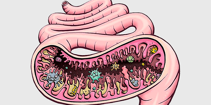 JТМ: при раке кишечника повышается активность трех групп бактерий