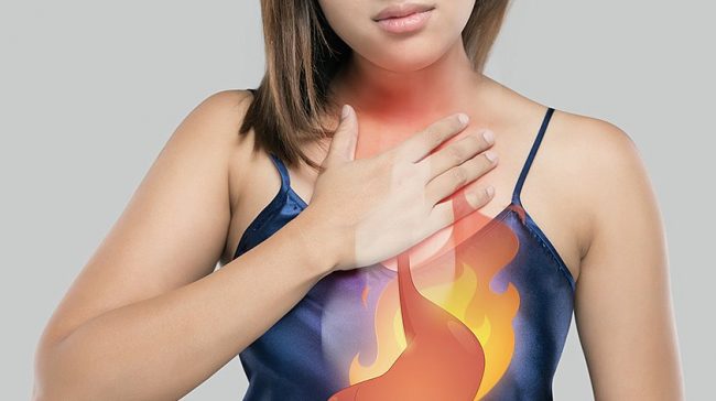 Почему появляется изжога, если не было переедания