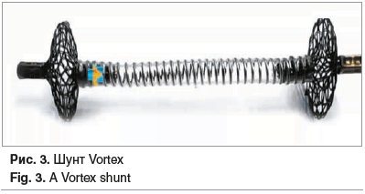 Рис. 3. Шунт Vortex Fig. 3. A Vortex shunt