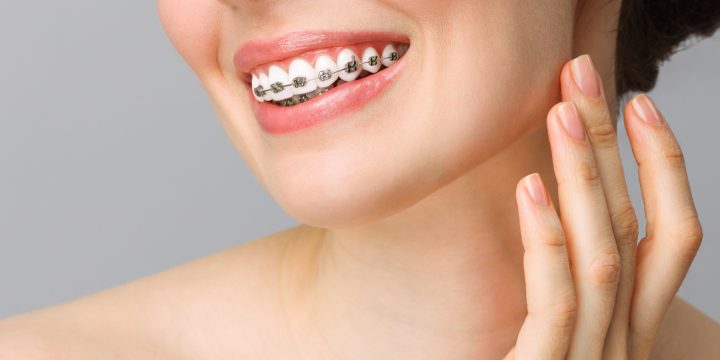 Россиян предостерегли от домашних методов исправления прикуса