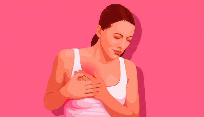 Nature: белок p95HER2 помогает раку груди защищаться от современных препаратов