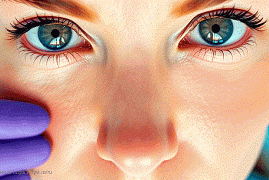 Лечение воспалительных заболеваний переднего отрезка глаза