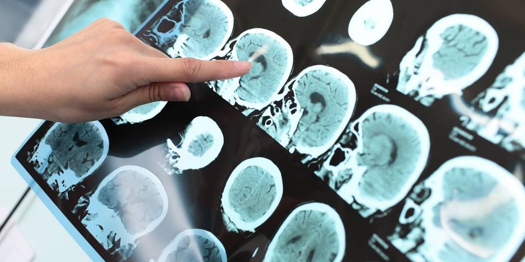 Назван простой способ замедлить старение мозга