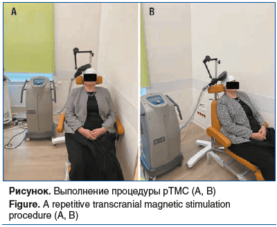Рисунок. Выполнение процедуры рТМС (А, В) Figure. A repetitive transcranial magnetic stimulation procedure (А, В)