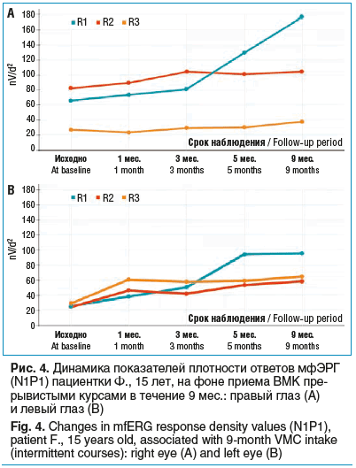 Рис. 4. Динамика показателей плотности ответов мфЭРГ (N1P1) пациентки Ф., 15 лет, на фоне приема ВМК пре- рывистыми курсами в течение 9 мес.: правый глаз (А) и левый глаз (B) Fig. 4. Changes in mfERG response density values (N1P1), patient F., 15 years ol