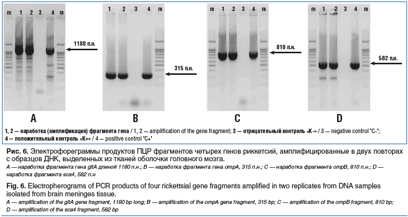 Рис. 6. Электрофореграммы продуктов ПЦР фрагментов четырех генов риккетсий, амплифицированные в двух повторах с образцов ДНК, выделенных из тканей оболочки головного мозга. A — наработка фрагмента гена gltA длиной 1180 п.н.; B — наработка фрагмента гена o