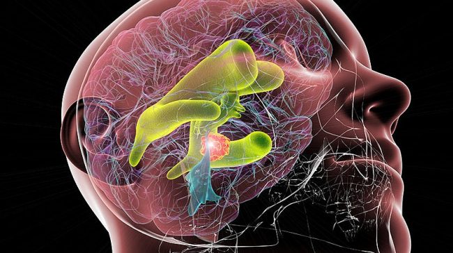 Зевание оказывает неожиданное влияние на жидкость внутри головного мозга