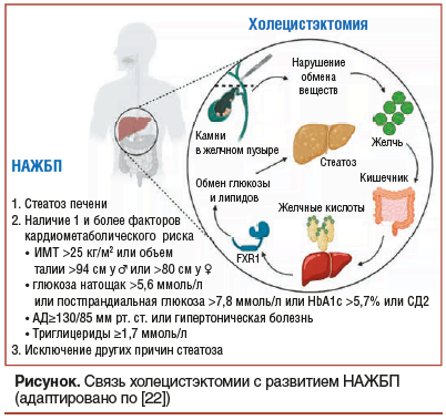 Рисунок. Связь холецистэктомии с развитием НАЖБП (адаптировано по [22])