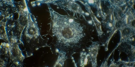 Грибок, обитающий в нашем организме, может сделать меланому более агрессивной