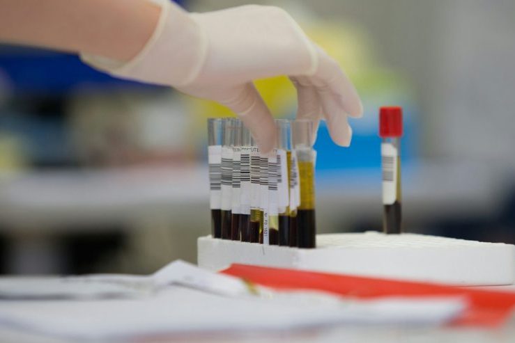 Ранние признаки болезни Паркинсона могут быть скрыты в крови