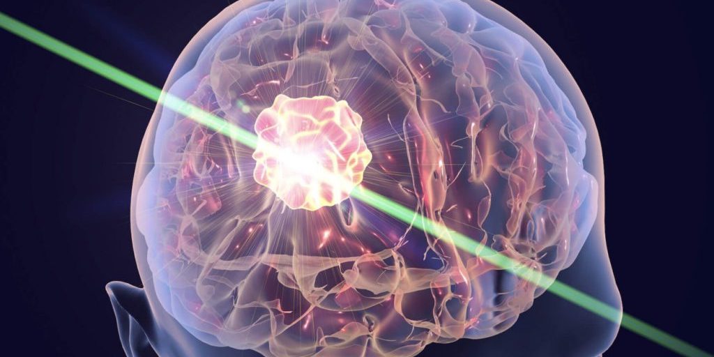 Neurology: постоянная умственная активность снижает риск болезни Альцгеймера