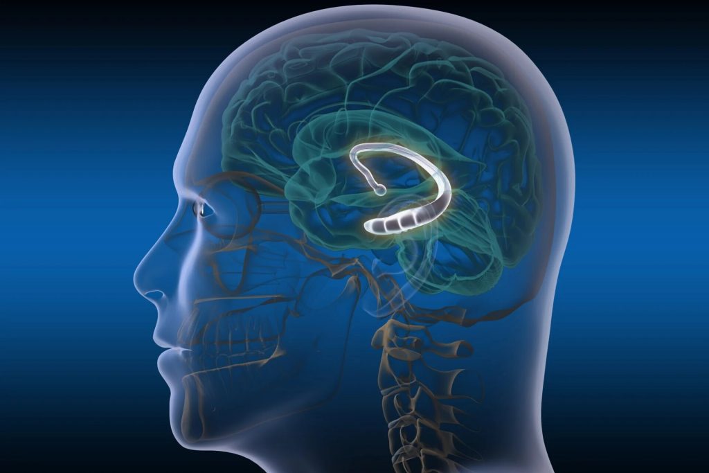 TP: левый гиппокамп предсказывает реакцию мозга на антидепрессант