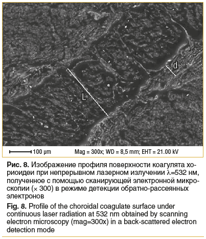Рис. 8. Изображение профиля поверхности коагулята хо- риоидеи при непрерывном лазерном излучении λ=532 нм, полученное с помощью сканирующей электронной микро- скопии (× 300) в режиме детекции обратно-рассеянных электронов Fig. 8. Profile of the choroidal Рис. 8. Изображение профиля поверхности коагулята хо- риоидеи при непрерывном лазерном излучении λ=532 нм, полученное с помощью сканирующей электронной микро- скопии (× 300) в режиме детекции обратно-рассеянных электронов Fig. 8. Profile of the choroidal