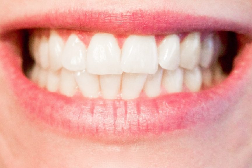Стоматолог-ортопед раскрыл неочевидную причину чувствительности зубов