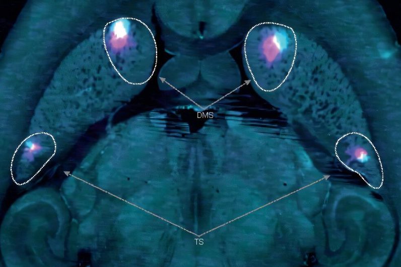 Обнаружен скрытый нейронный путь в мозге, помогающий контролировать движения рук