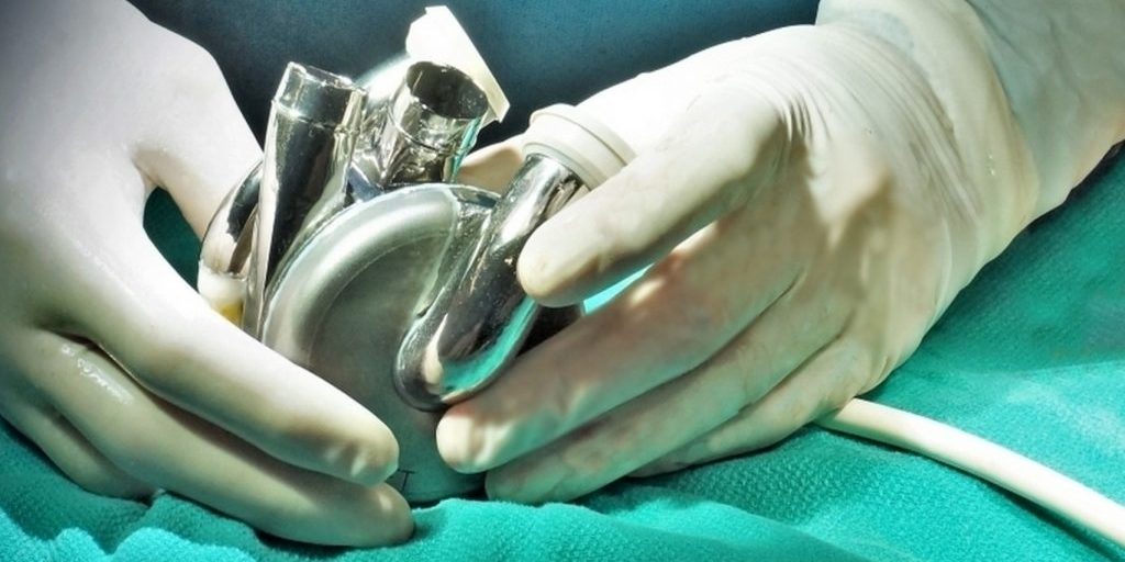 Хирург Жульков назвал маловероятным создание искусственного сердца