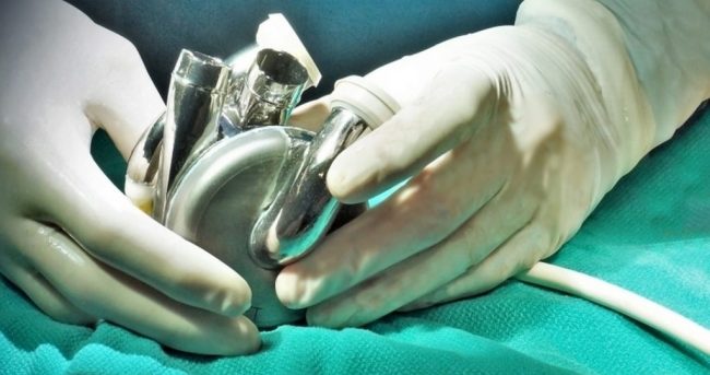 Хирург Жульков назвал маловероятным создание искусственного сердца