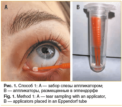 Рис. 1. Способ 1: А — забор слезы аппликатором; В — аппликаторы, размещенные в эппендорфе Fig. 1. Method 1: A — tear sampling with an applicator, В — applicators placed in an Eppendorf tube