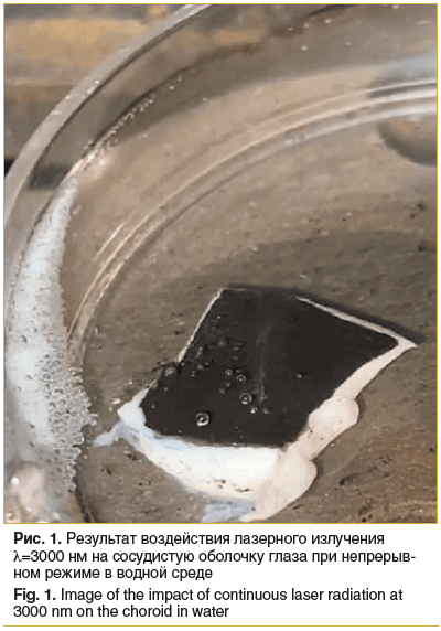 Рис. 1. Результат воздействия лазерного излучения λ=3000 нм на сосудистую оболочку глаза при непрерыв- ном режиме в водной среде Fig. 1. Image of the impact of continuous laser radiation at 3000 nm on the choroid in water Рис. 1. Результат воздействия лазерного излучения λ=3000 нм на сосудистую оболочку глаза при непрерыв- ном режиме в водной среде Fig. 1. Image of the impact of continuous laser radiation at 3000 nm on the choroid in water