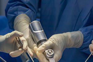 СамГМУ разработал первый в мире детский раздвижной эндопротез голеностопного сустава