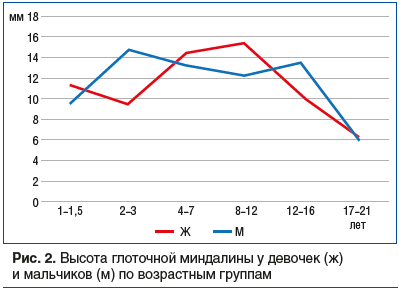 Рис. 2. Высота глоточной миндалины у девочек (ж) и мальчиков (м) по возрастным группам