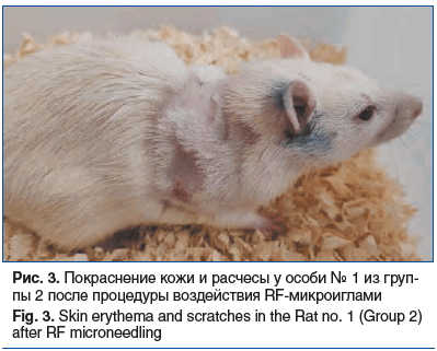 Рис. 3. Покраснение кожи и расчесы у особи № 1 из груп- пы 2 после процедуры воздействия RF-микроиглами Fig. 3. Skin erythema and scratches in the Rat no. 1 (Group 2) after RF microneedling Рис. 3. Покраснение кожи и расчесы у особи № 1 из груп- пы 2 после процедуры воздействия RF-микроиглами Fig. 3. Skin erythema and scratches in the Rat no. 1 (Group 2) after RF microneedling