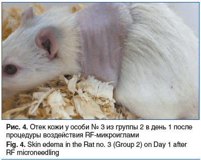 Рис. 4. Отек кожи у особи № 3 из группы 2 в день 1 после процедуры воздействия RF-микроиглами Fig. 4. Skin edema in the Rat no. 3 (Group 2) on Day 1 after RF microneedling Рис. 4. Отек кожи у особи № 3 из группы 2 в день 1 после процедуры воздействия RF-микроиглами Fig. 4. Skin edema in the Rat no. 3 (Group 2) on Day 1 after RF microneedling